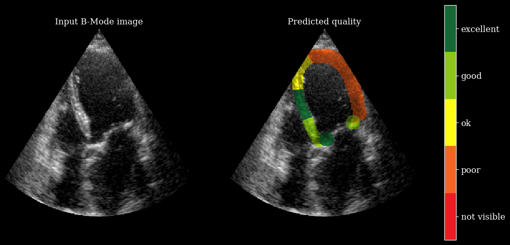 myocardial image quality